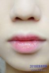  촽